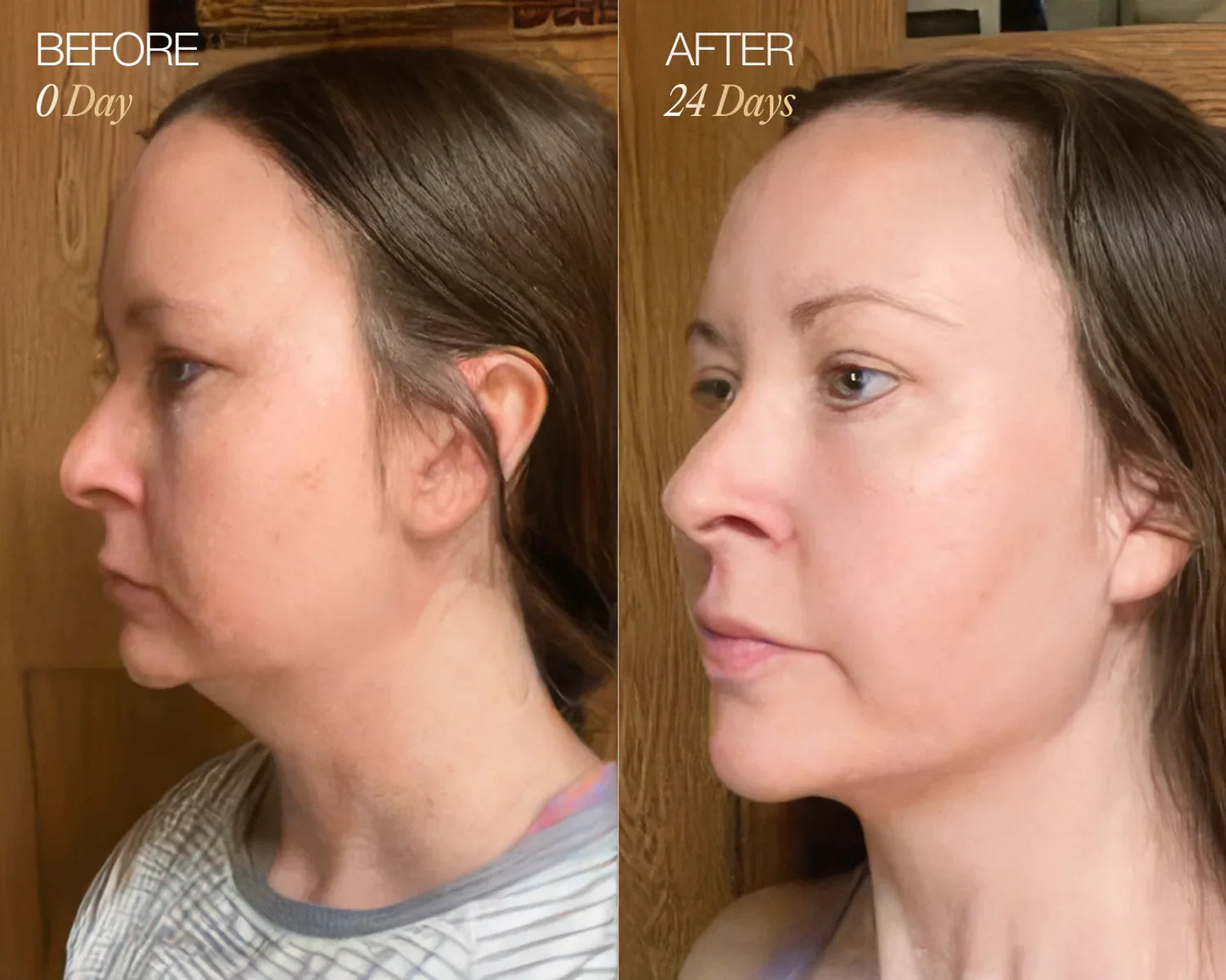 Lymphatic Face Brush – Sculpt & Depuff